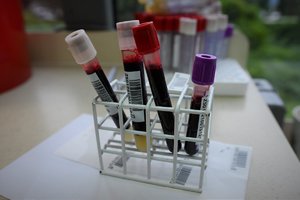Zdjęcie kolorowe. Widoczne pojemniki z krwią