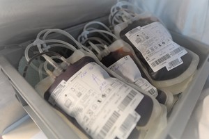 Zdjęcie. Krew pobrana od dawców