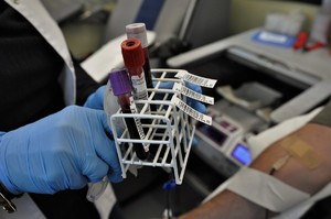 zdjęcie przedstawia próbówki z krwią trzymane w dłoniach