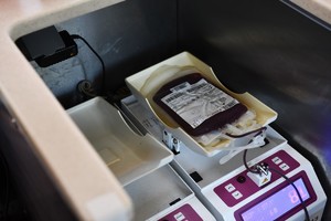 zdjęcie przedstawia woreczek z krwią w trakcie pobierania od dawcy.