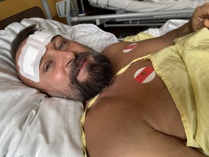 na zdjęciu widać mężczyznę z opatrunkiem